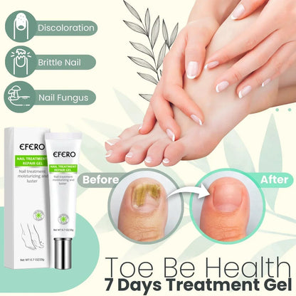 Nail Repair Treatment Gel